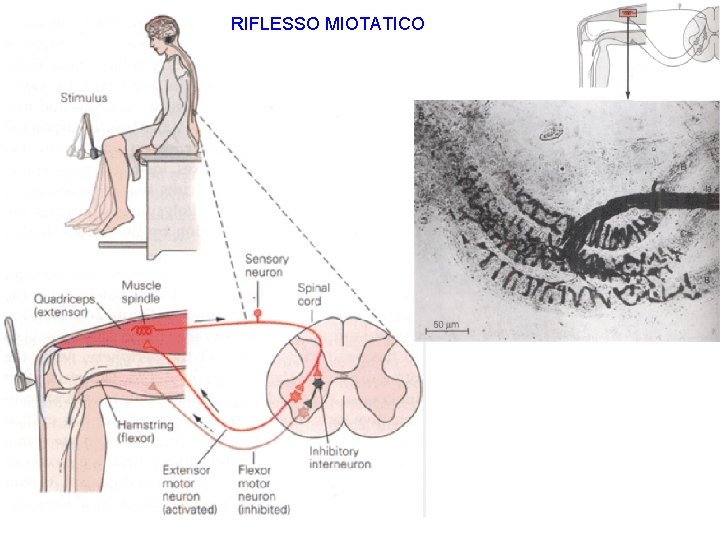 RIFLESSO MIOTATICO 