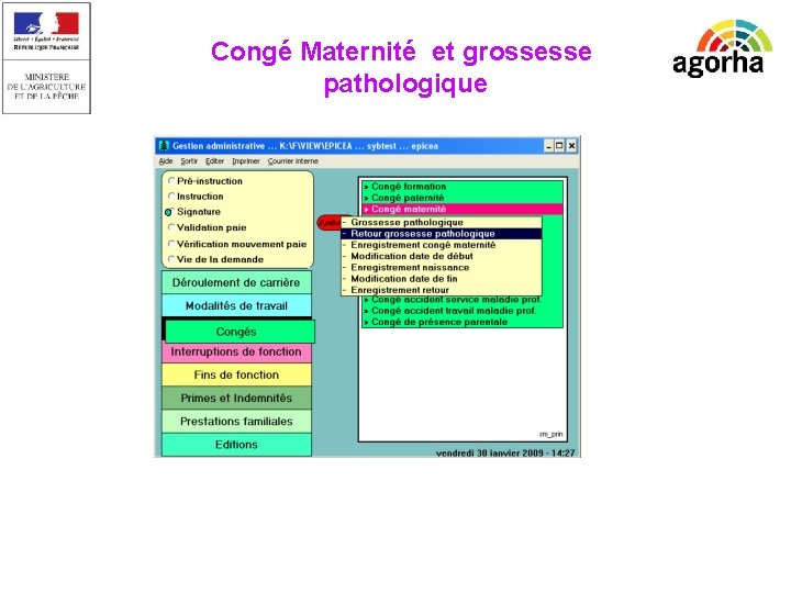 EPICEA Congé Maternité et grossesse pathologique 