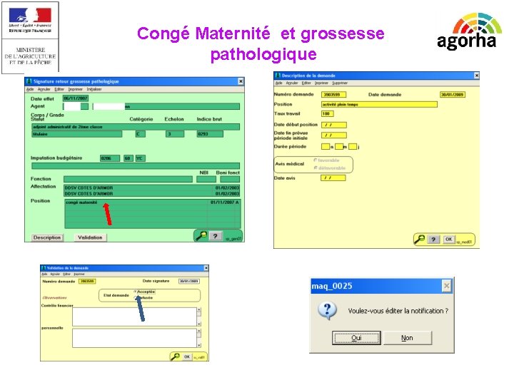 EPICEA Congé Maternité et grossesse pathologique Manque la description 