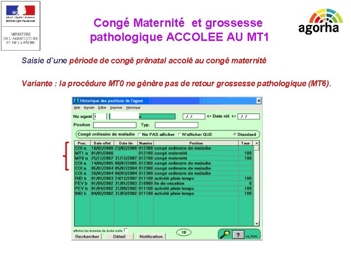 Congé Maternité et grossesse pathologique ACCOLEE AU MT 1 Saisie d’une période de congé