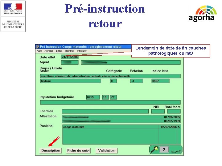 Pré-instruction retour Lendemain de date de fin couches pathologiques ou mt 3 sg/srh/misirh 