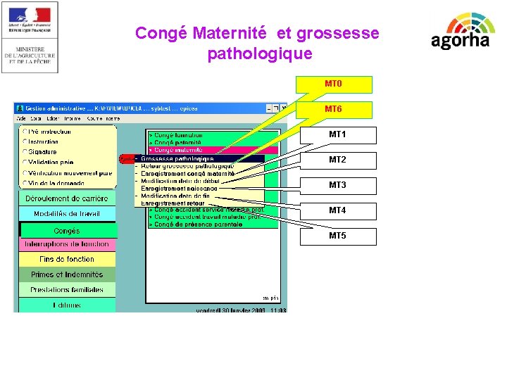 EPICEA Congé Maternité et grossesse pathologique MT 0 MT 6 MT 1 MT 2