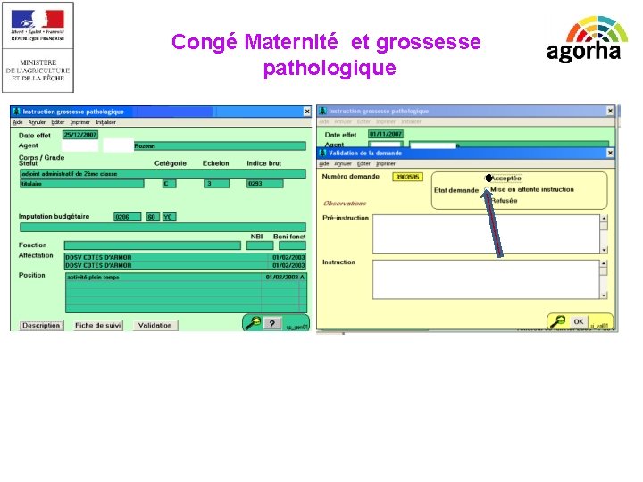 EPICEA Congé Maternité et grossesse pathologique 