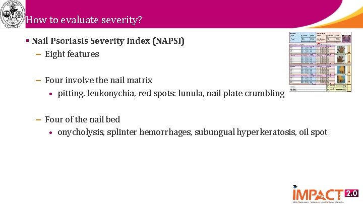 How to evaluate severity? § Nail Psoriasis Severity Index (NAPSI) – Eight features –