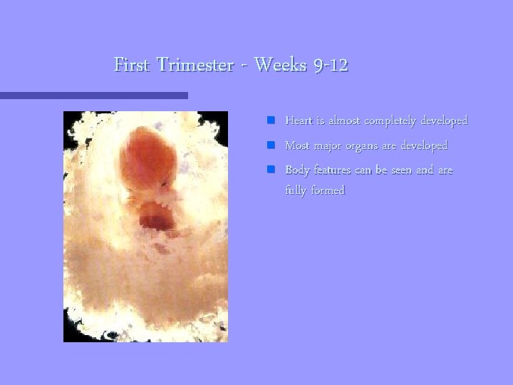 First Trimester - Weeks 9 -12 n n n Heart is almost completely developed