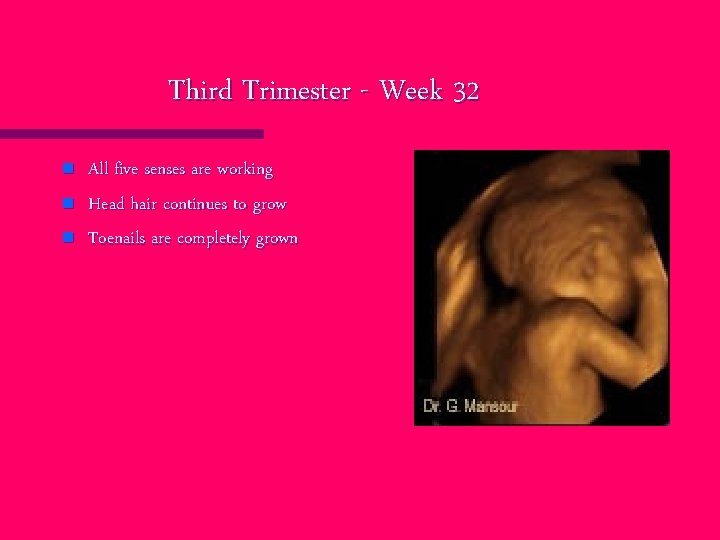 Third Trimester - Week 32 n n n All five senses are working Head