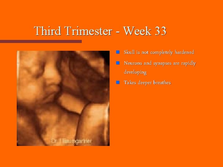 Third Trimester - Week 33 n n n Skull is not completely hardened Neurons