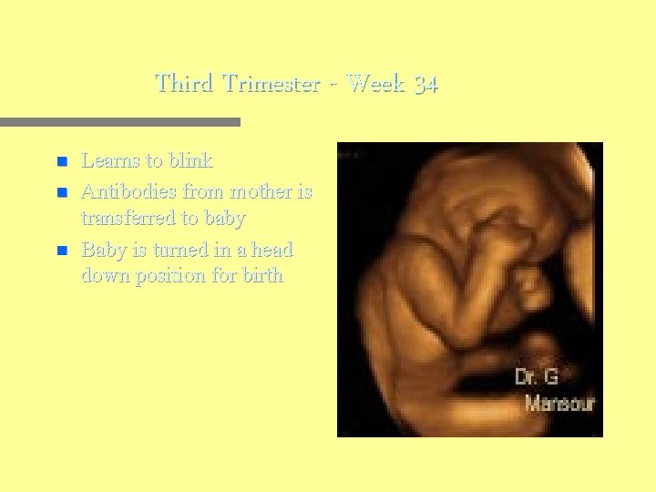 Third Trimester - Week 34 n n n Learns to blink Antibodies from mother