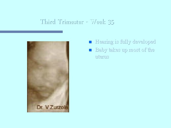 Third Trimester - Week 35 n n Hearing is fully developed Baby takes up