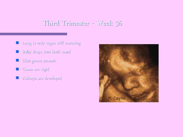 Third Trimester - Week 36 n n n Lung is only organ still maturing
