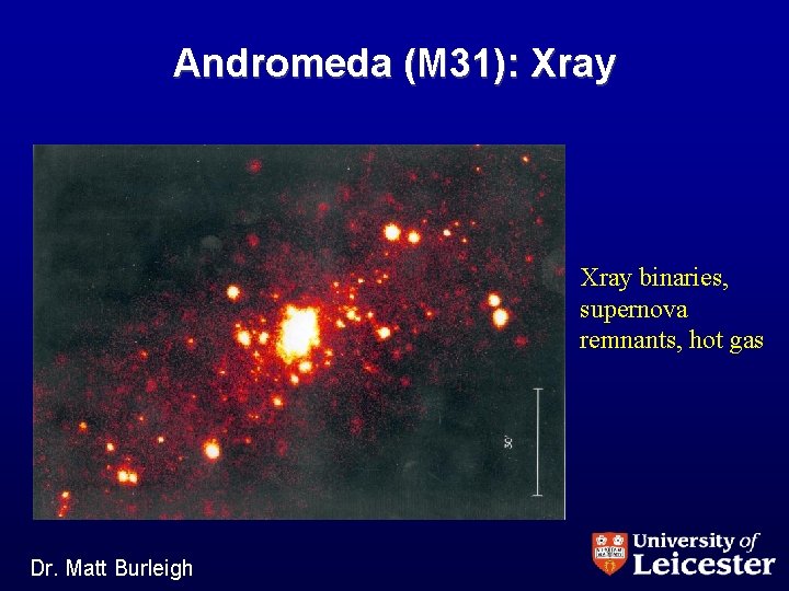 Andromeda (M 31): Xray binaries, supernova remnants, hot gas Dr. Matt Burleigh 