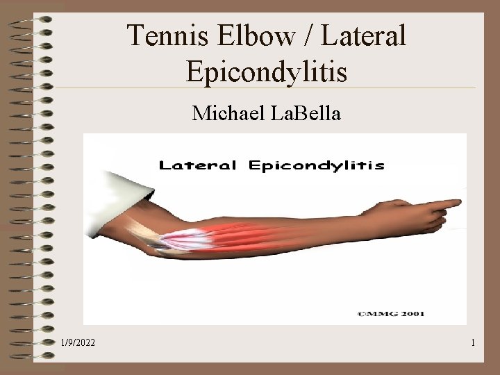 Tennis Elbow / Lateral Epicondylitis Michael La. Bella 1/9/2022 1 