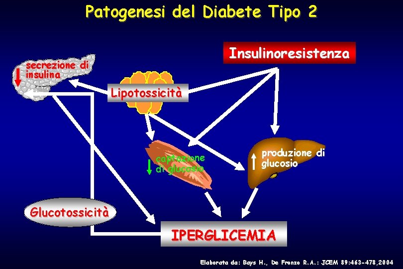Patogenesi del Diabete Tipo 2 Insulinoresistenza secrezione di insulina FFA, Tg Lipotossicità captazione di