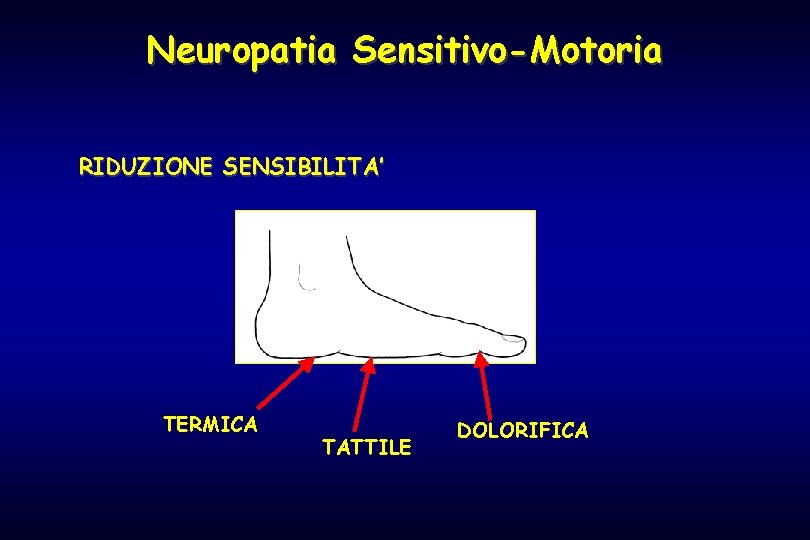 Neuropatia Sensitivo-Motoria RIDUZIONE SENSIBILITA’ TERMICA TATTILE DOLORIFICA 