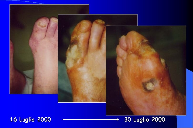 16 Luglio 2000 30 Luglio 2000 
