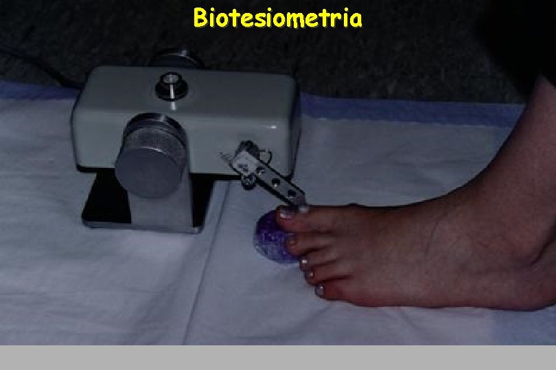 Biotesiometria 