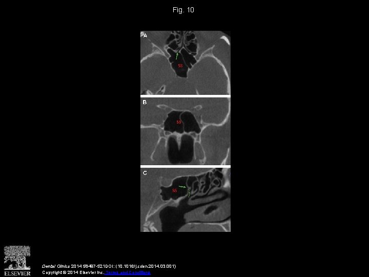 Fig. 10 Dental Clinics 2014 58497 -521 DOI: (10. 1016/j. cden. 2014. 03. 001)