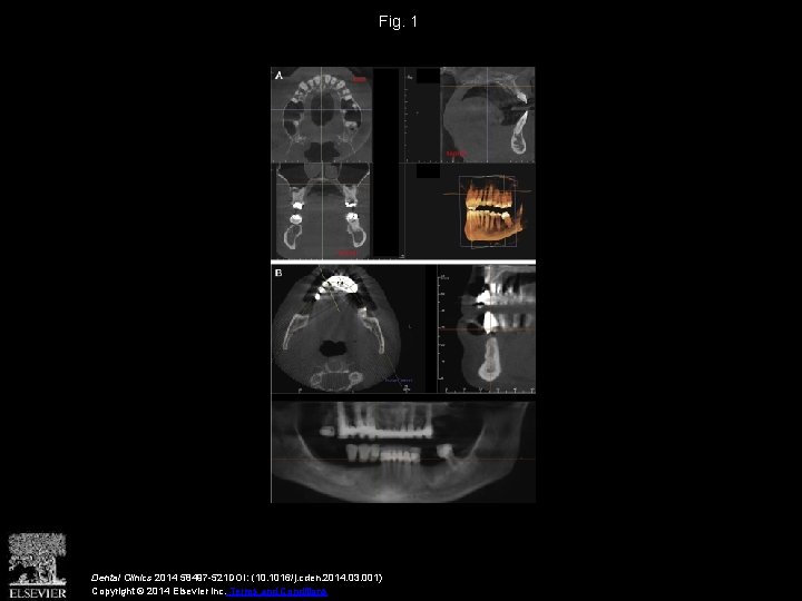 Fig. 1 Dental Clinics 2014 58497 -521 DOI: (10. 1016/j. cden. 2014. 03. 001)