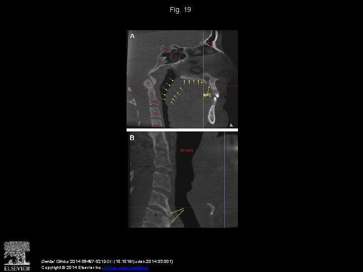 Fig. 19 Dental Clinics 2014 58497 -521 DOI: (10. 1016/j. cden. 2014. 03. 001)