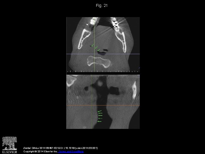 Fig. 21 Dental Clinics 2014 58497 -521 DOI: (10. 1016/j. cden. 2014. 03. 001)