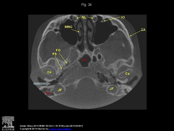 Fig. 24 Dental Clinics 2014 58497 -521 DOI: (10. 1016/j. cden. 2014. 03. 001)