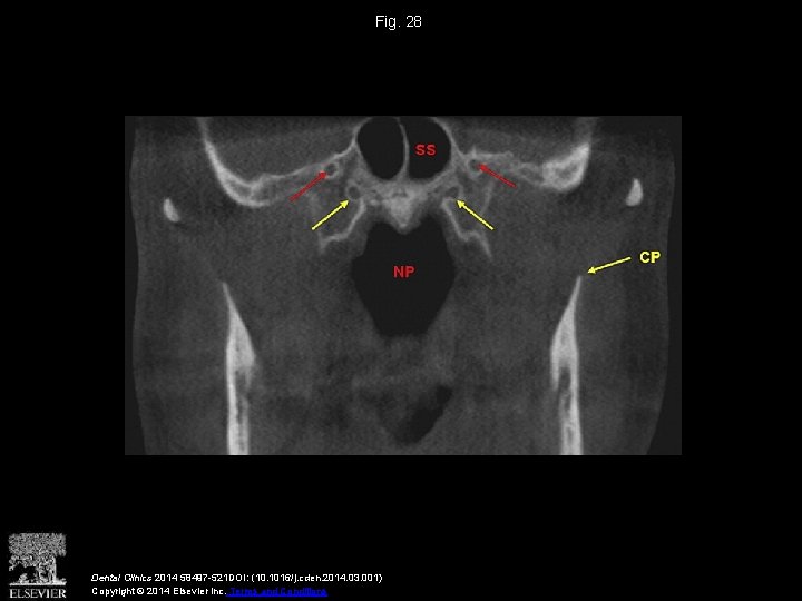 Fig. 28 Dental Clinics 2014 58497 -521 DOI: (10. 1016/j. cden. 2014. 03. 001)
