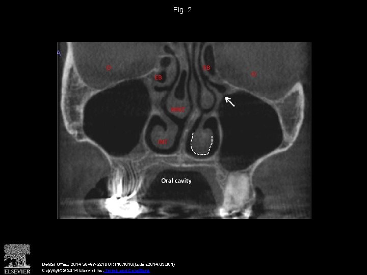Fig. 2 Dental Clinics 2014 58497 -521 DOI: (10. 1016/j. cden. 2014. 03. 001)