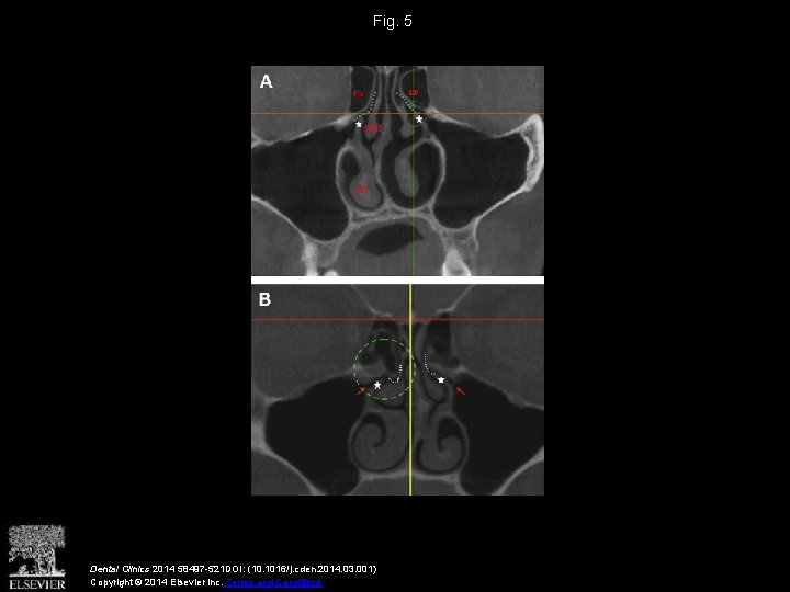 Fig. 5 Dental Clinics 2014 58497 -521 DOI: (10. 1016/j. cden. 2014. 03. 001)