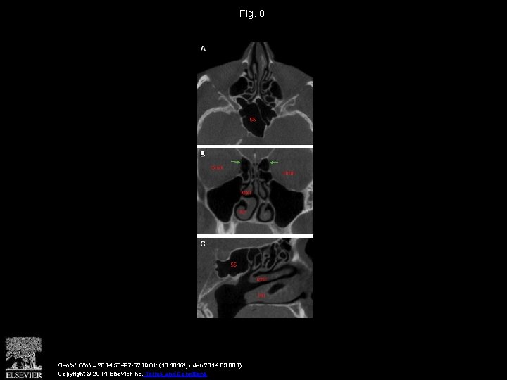 Fig. 8 Dental Clinics 2014 58497 -521 DOI: (10. 1016/j. cden. 2014. 03. 001)