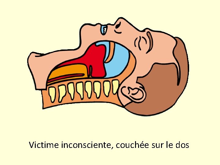 Linconscience Principales causes Mdicales maladies atteignant le cerveau