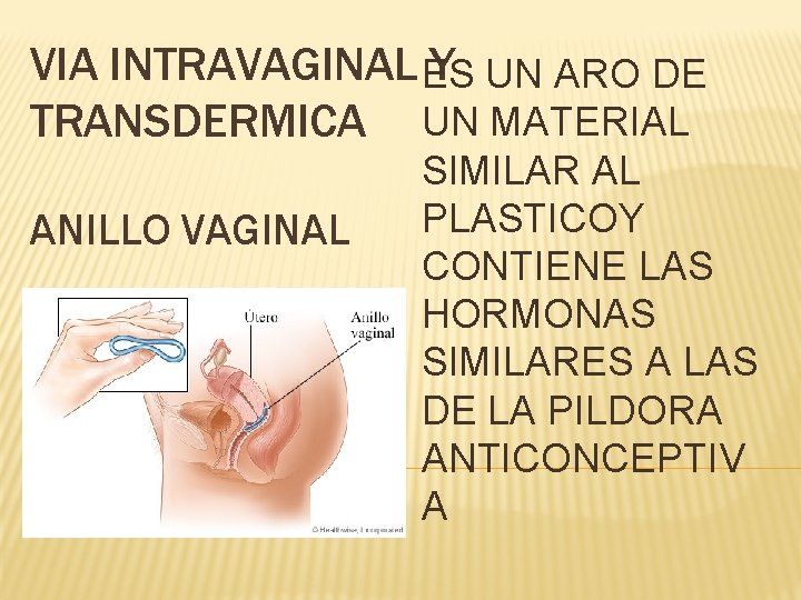 VIA INTRAVAGINAL ES Y UN ARO DE TRANSDERMICA UN MATERIAL ANILLO VAGINAL SIMILAR AL