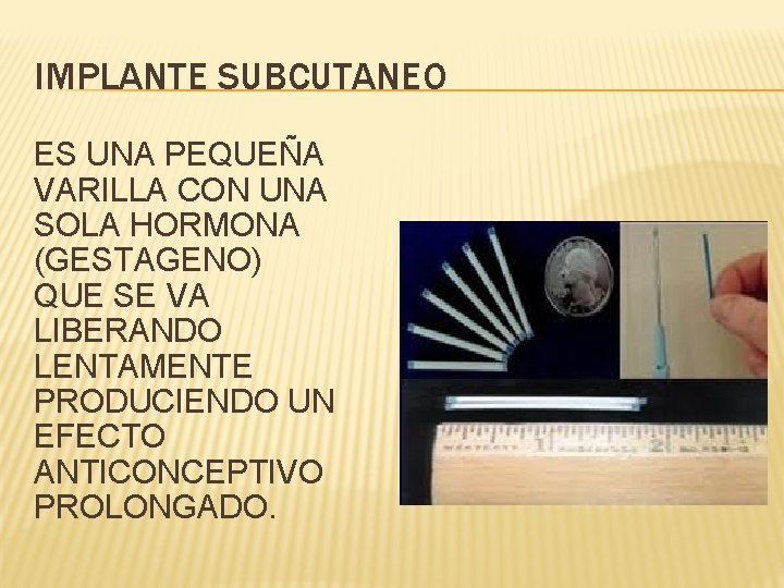 IMPLANTE SUBCUTANEO ES UNA PEQUEÑA VARILLA CON UNA SOLA HORMONA (GESTAGENO) QUE SE VA