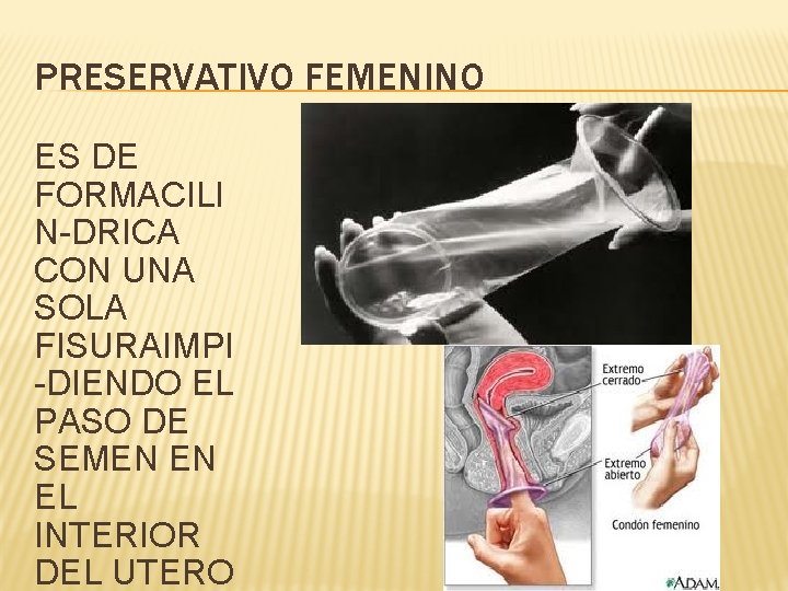 PRESERVATIVO FEMENINO ES DE FORMACILI N-DRICA CON UNA SOLA FISURAIMPI -DIENDO EL PASO DE