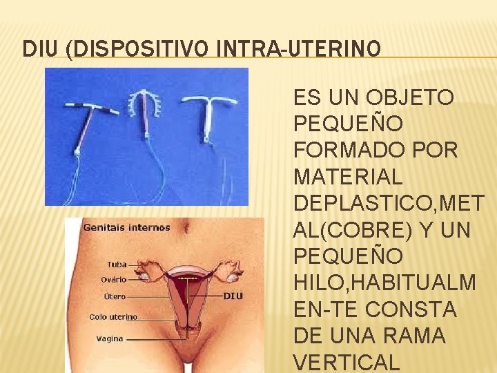 DIU (DISPOSITIVO INTRA-UTERINO ES UN OBJETO PEQUEÑO FORMADO POR MATERIAL DEPLASTICO, MET AL(COBRE) Y