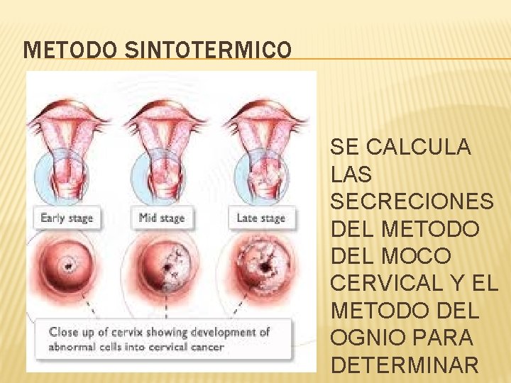 METODO SINTOTERMICO SE CALCULA LAS SECRECIONES DEL METODO DEL MOCO CERVICAL Y EL METODO