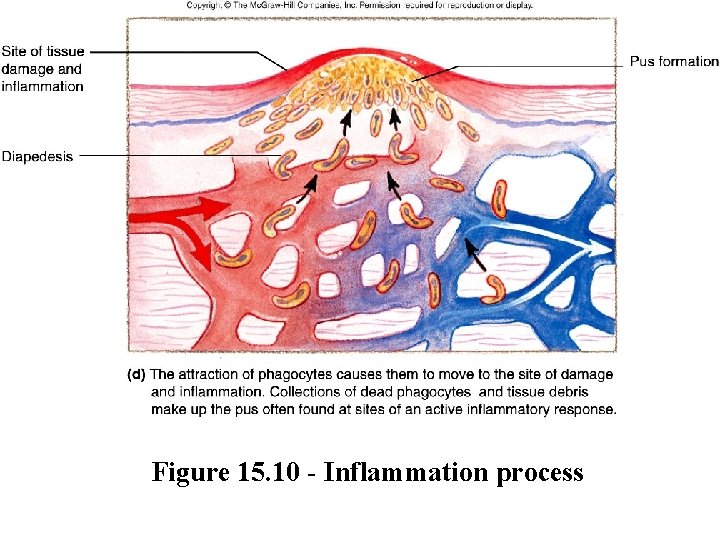 Figure 15. 10 - Inflammation process 