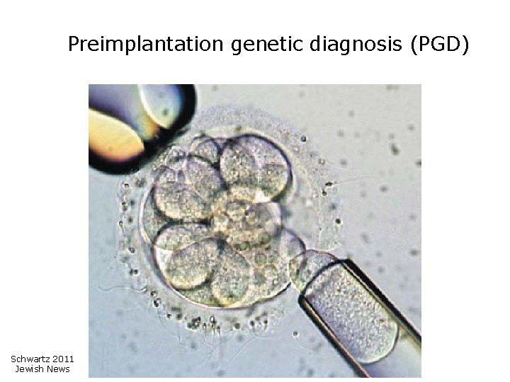 Preimplantation genetic diagnosis (PGD) Schwartz 2011 Jewish News 