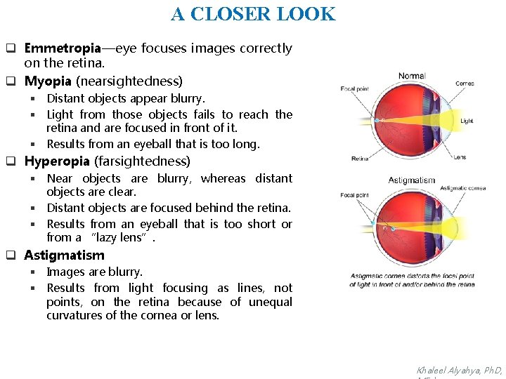 A CLOSER LOOK q Emmetropia—eye focuses images correctly on the retina. q Myopia (nearsightedness)