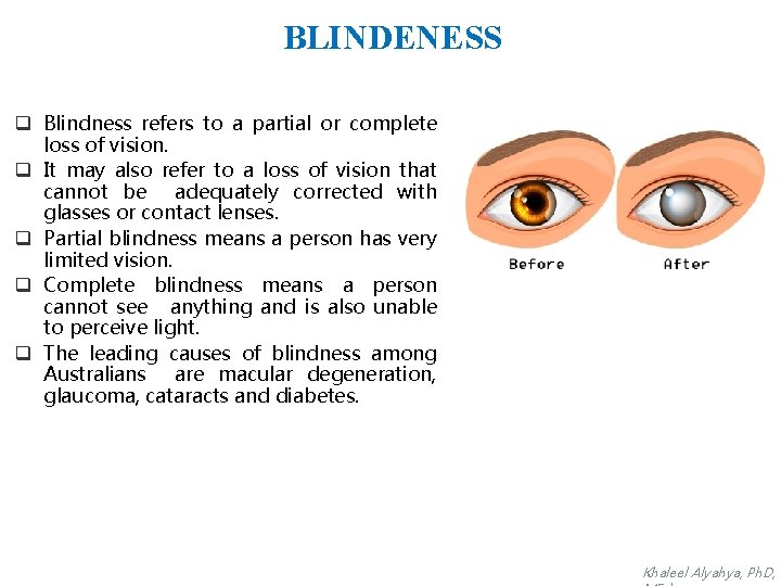 BLINDENESS q Blindness refers to a partial or complete loss of vision. q It