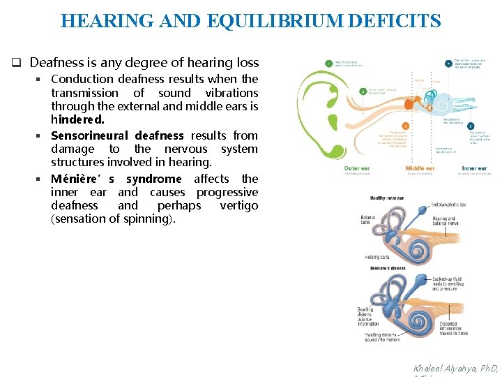 HEARING AND EQUILIBRIUM DEFICITS q Deafness is any degree of hearing loss § Conduction