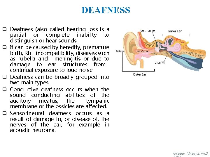 DEAFNESS q Deafness (also called hearing loss is a partial or complete inability to