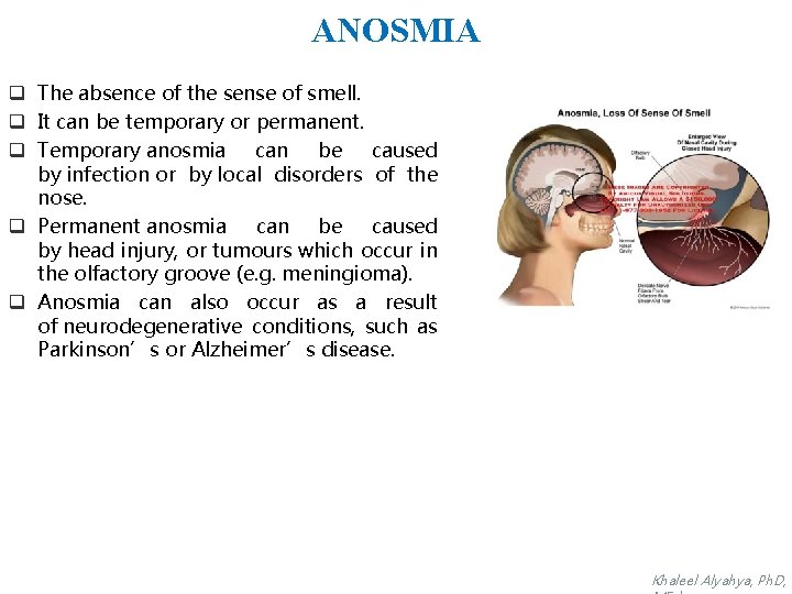 ANOSMIA q The absence of the sense of smell. q It can be temporary