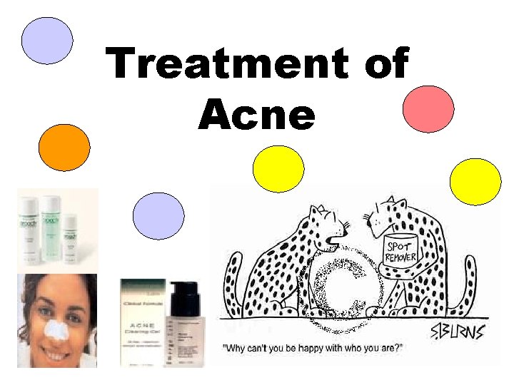 Treatment of Acne Treatment of Acne