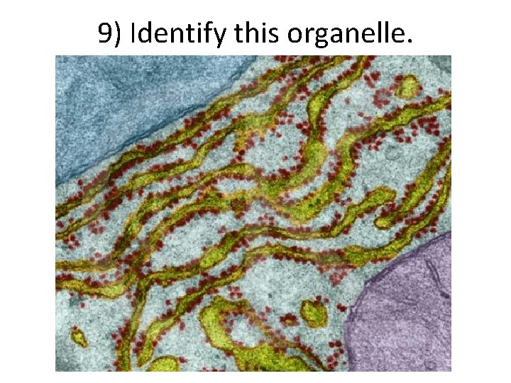 9) Identify this organelle. 