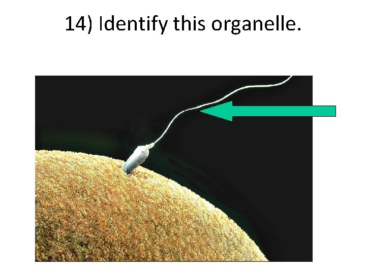 14) Identify this organelle. 