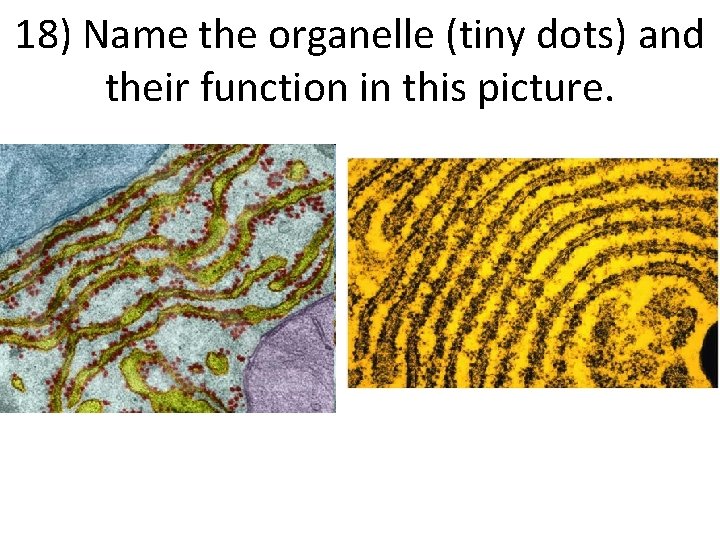 18) Name the organelle (tiny dots) and their function in this picture. 