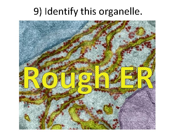 9) Identify this organelle. Rough ER 