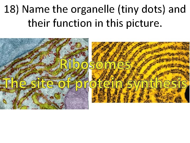 18) Name the organelle (tiny dots) and their function in this picture. Ribosomes The