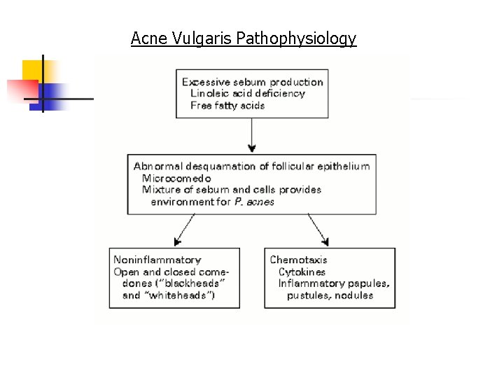 Acne Vulgaris Pathophysiology 