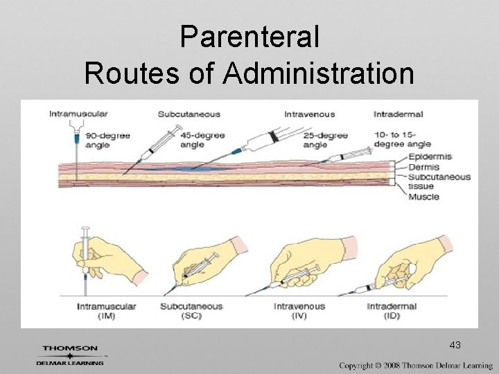 Parenteral Routes of Administration 43 